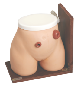 高级瘘管造口术护理  38.png