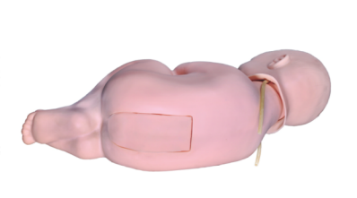 婴儿腰椎穿刺模型  L60B.png